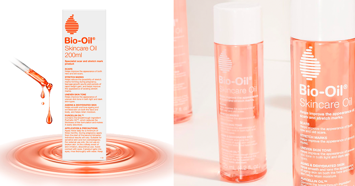 Best Stretch Mark Creams, Serums and Oils in Singapore Vanilla Luxury